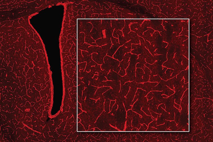 MRI technique detects light-emitting molecules deep inside the brain – Physics World